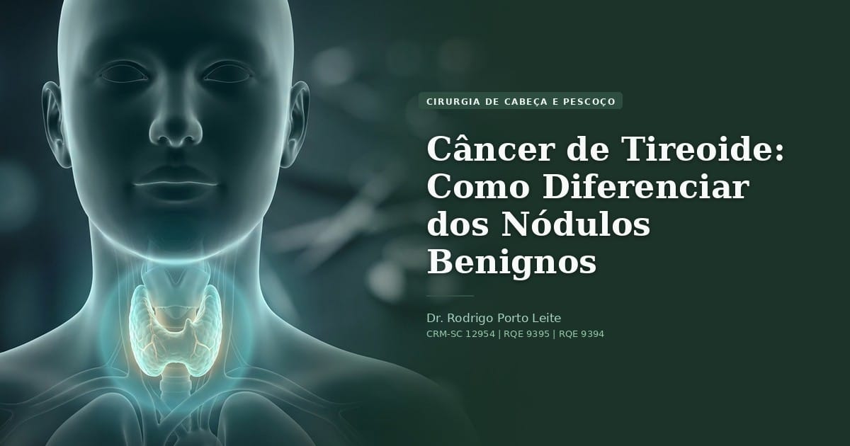 Câncer de Tireoide: Como Diferenciar dos Nódulos Benignos